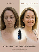 Collagen Essence Gold – Formule Anti-Âge Ultime (Collagène Marin 12 500 mg & Rétinol) Nutremys